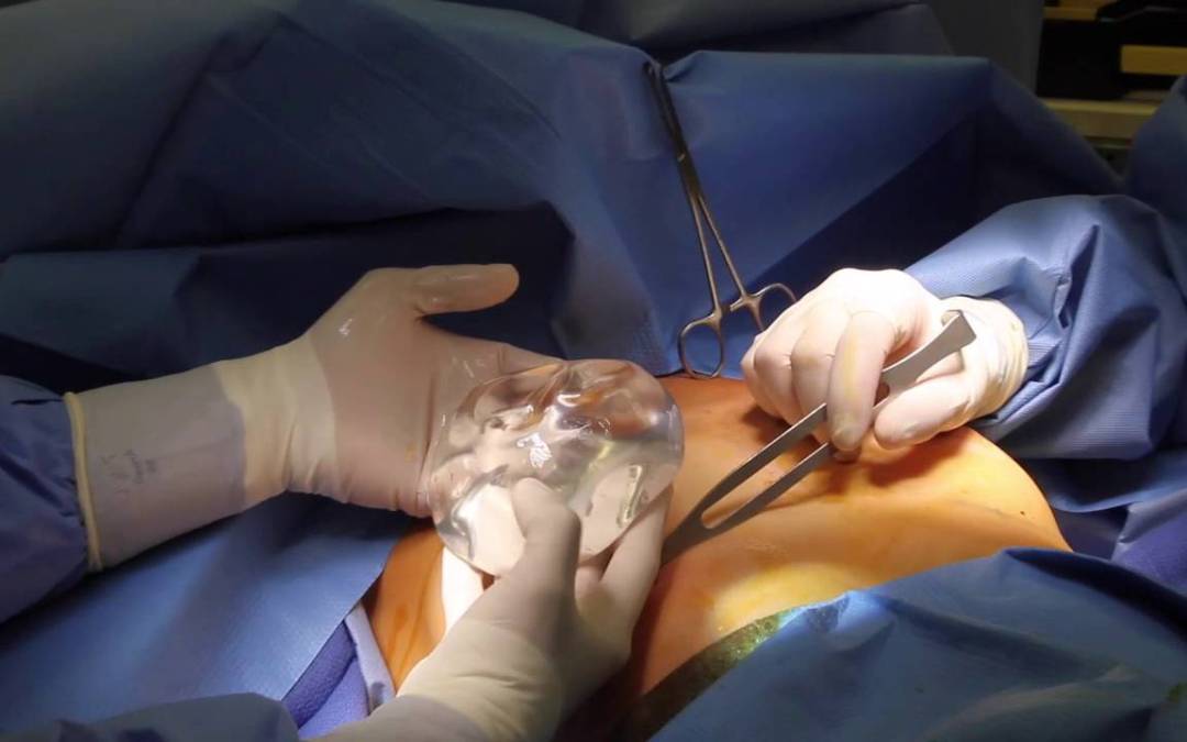 trach-nhiem-khi-bac-si-tham-my-vien-lam-dep-gay-chet-nguoi